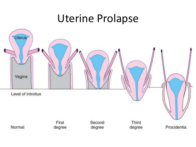 ayurvedic treatment of the uterus