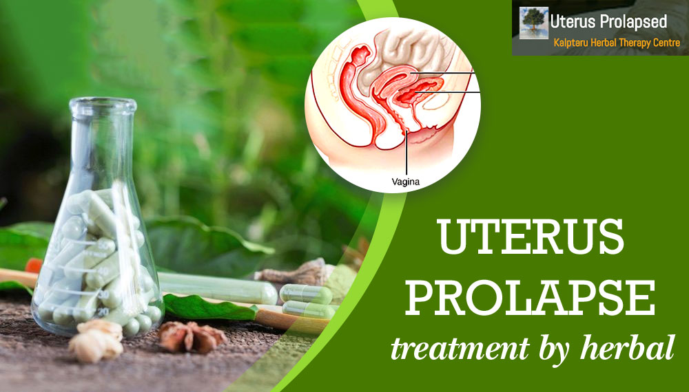 Uterus Prolapse Treatment By Herbal