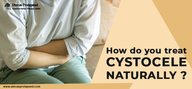 How do you treat Cystocele naturally