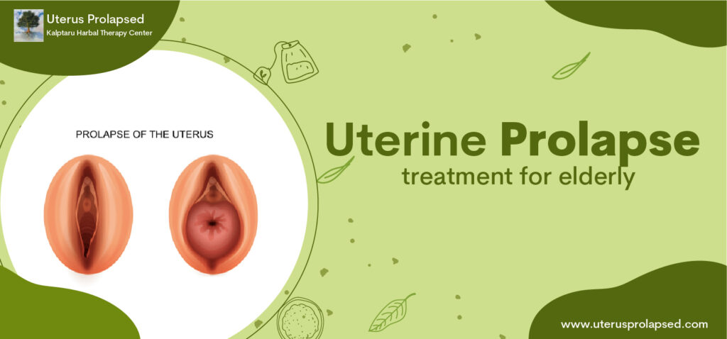 Uterine Prolapse Treatment for Elderly