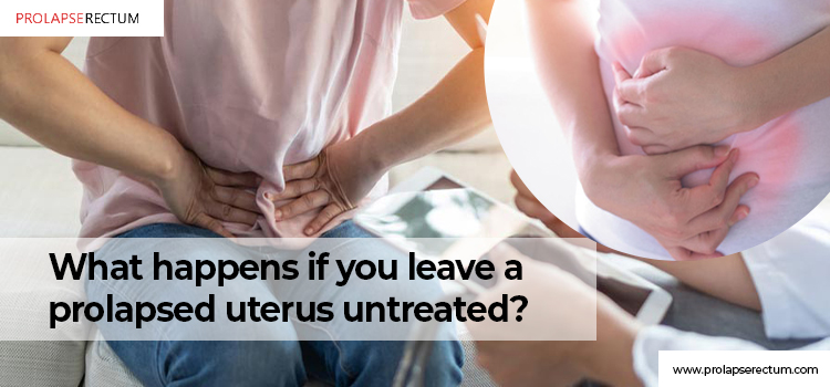 What Happens If You Leave A Prolapsed Uterus Untreated?