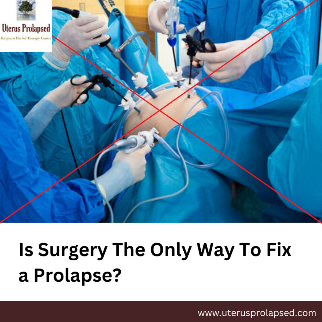 Is Surgery the Only Way to Fix a Prolapse