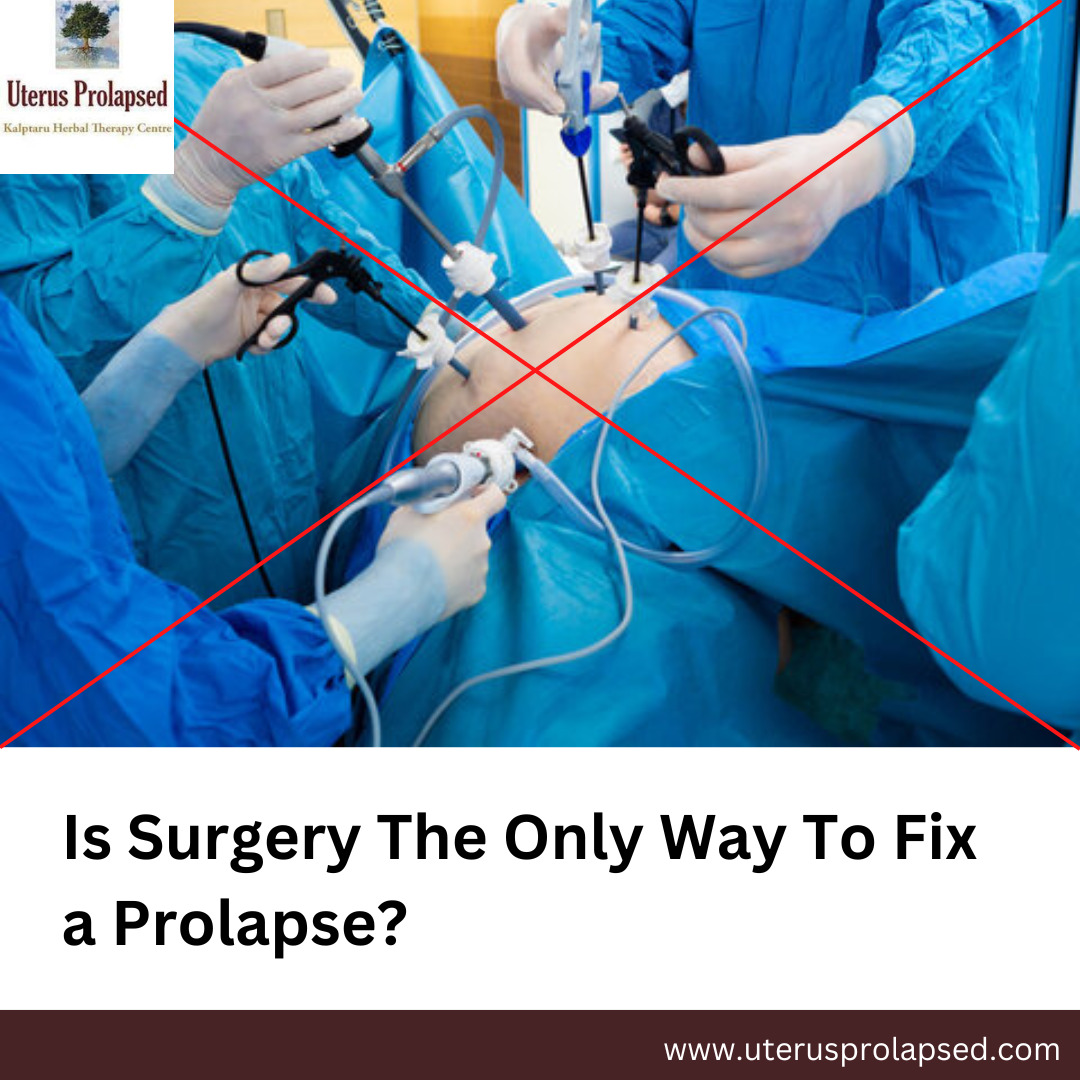 Is Surgery the Only Way to Fix a Prolapse?