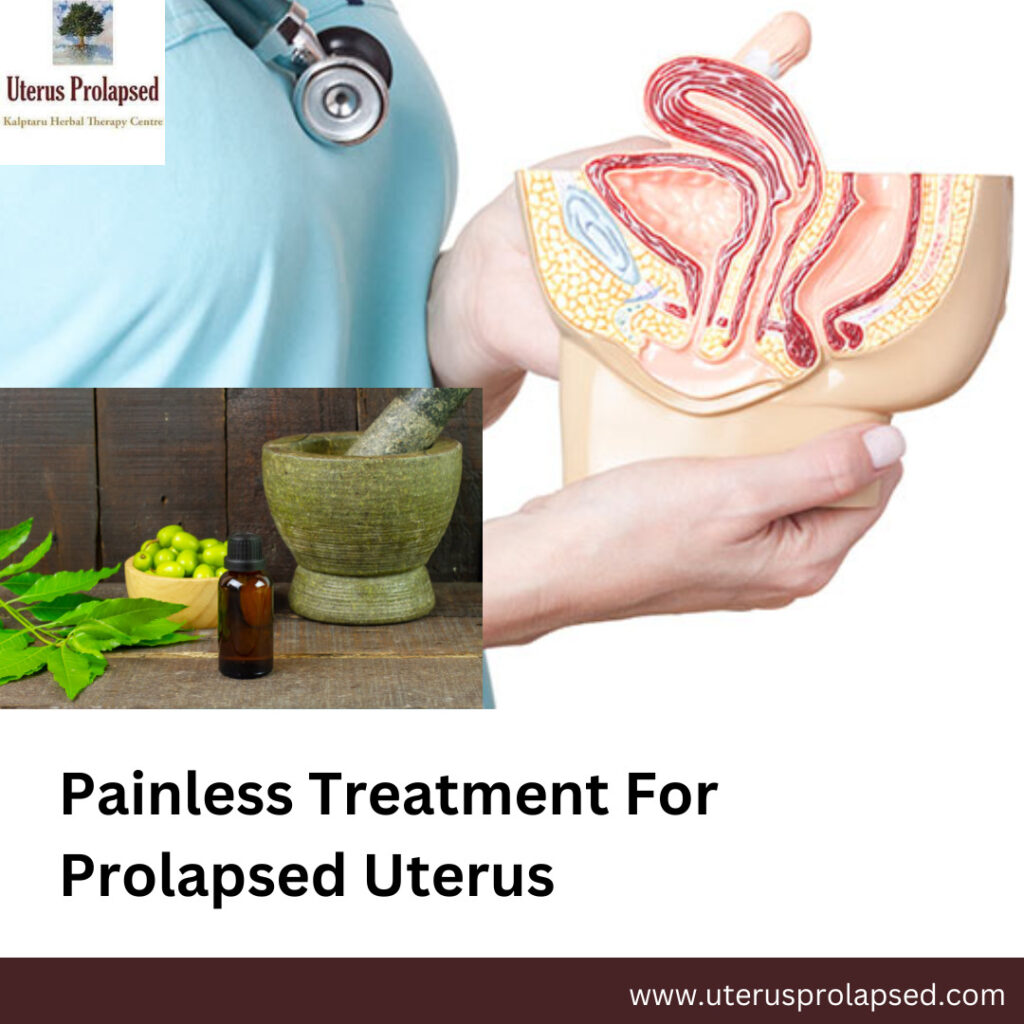 Uterus Prolapsed - painless treatment for prolapsed uterus