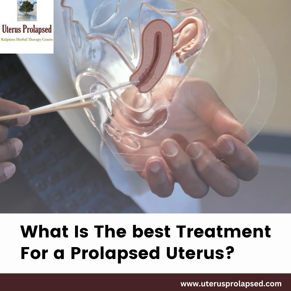 Uterus Prolapsed - What is the best treatment for a prolapsed uterus