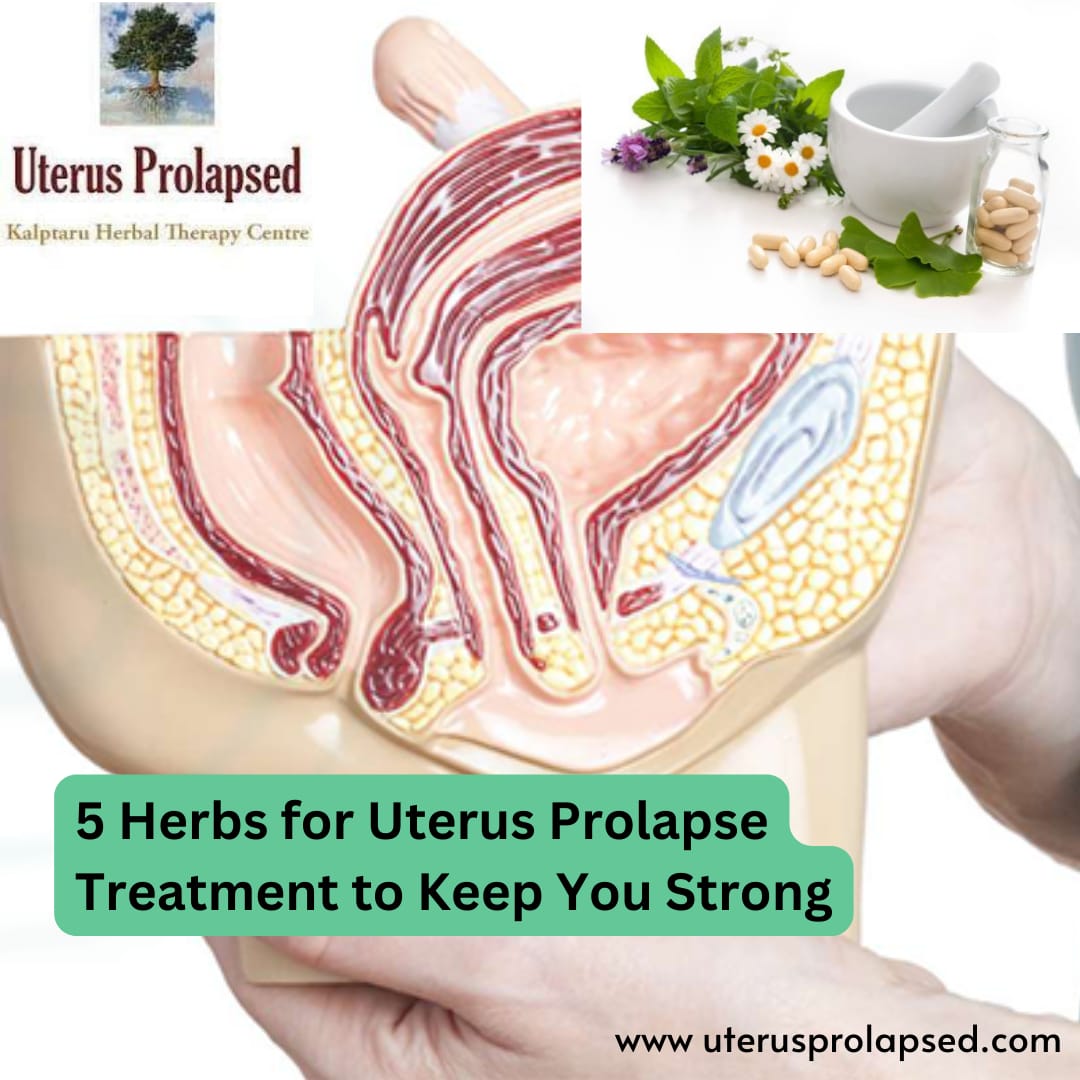 5 Herbs for Uterus Prolapse Treatment to Keep You Strong