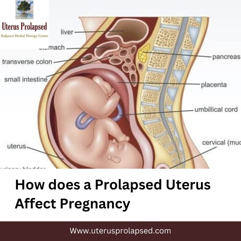 How Does a Prolapsed Uterus Affect Pregnancy?