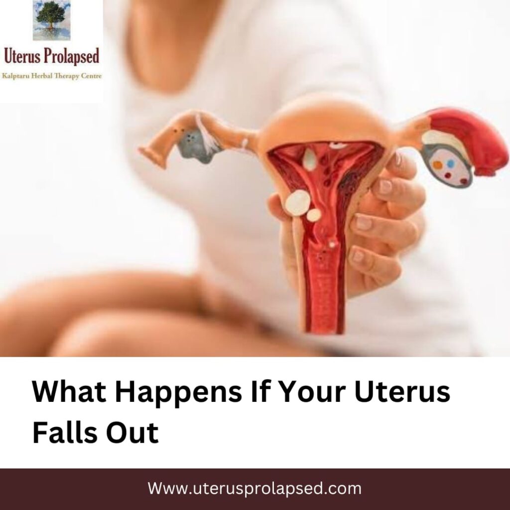 What Happens If Your Uterus Falls Out?