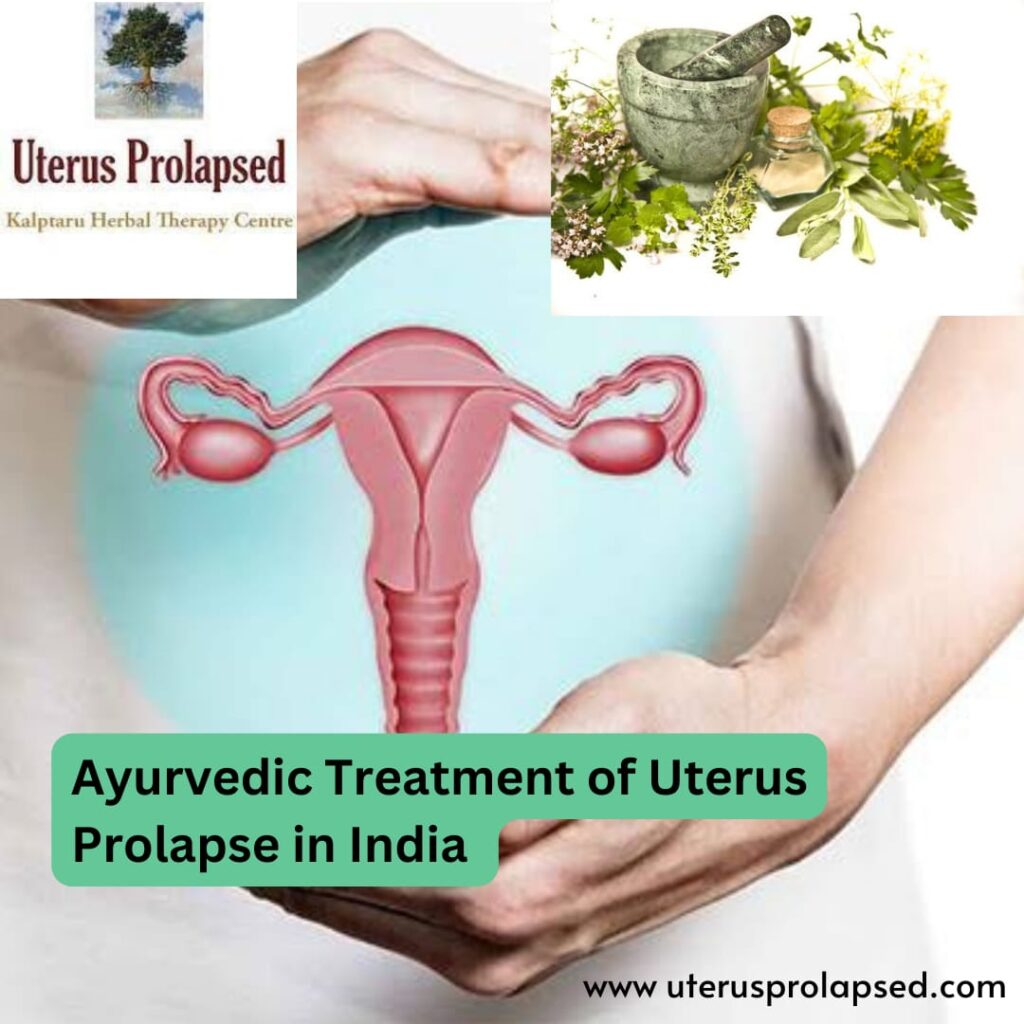 Ayurvedic Treatment of Uterus Prolapse in India