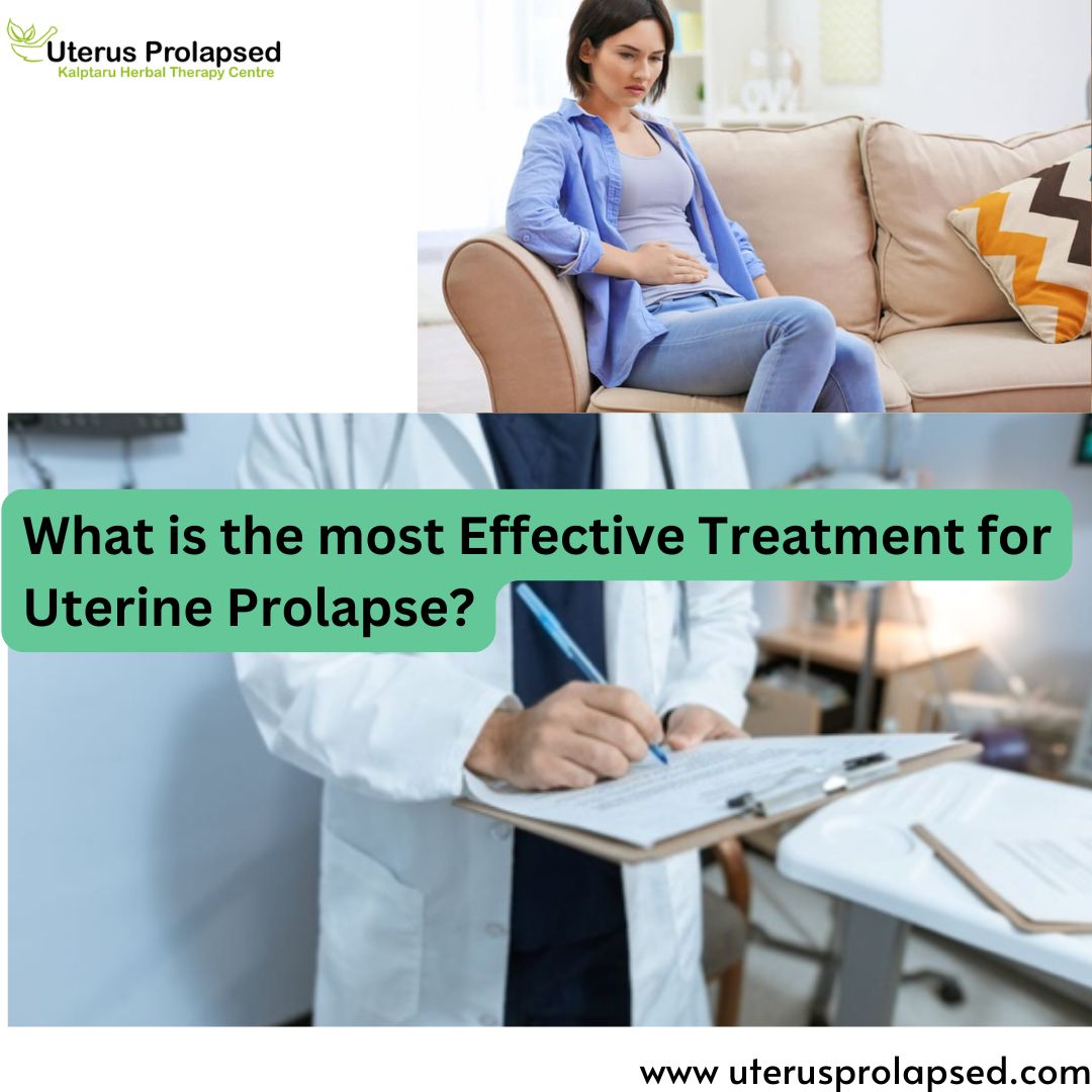 What Is the Most Effective Treatment for Uterine Prolapse?