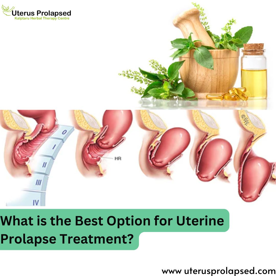 What Is the Best Option for Uterine Prolapse Treatment?