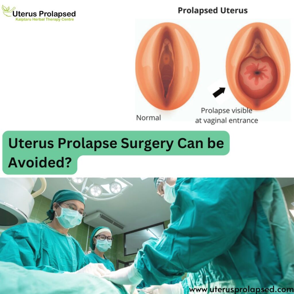 Uterus Prolapse Surgery Can Be Avoided?