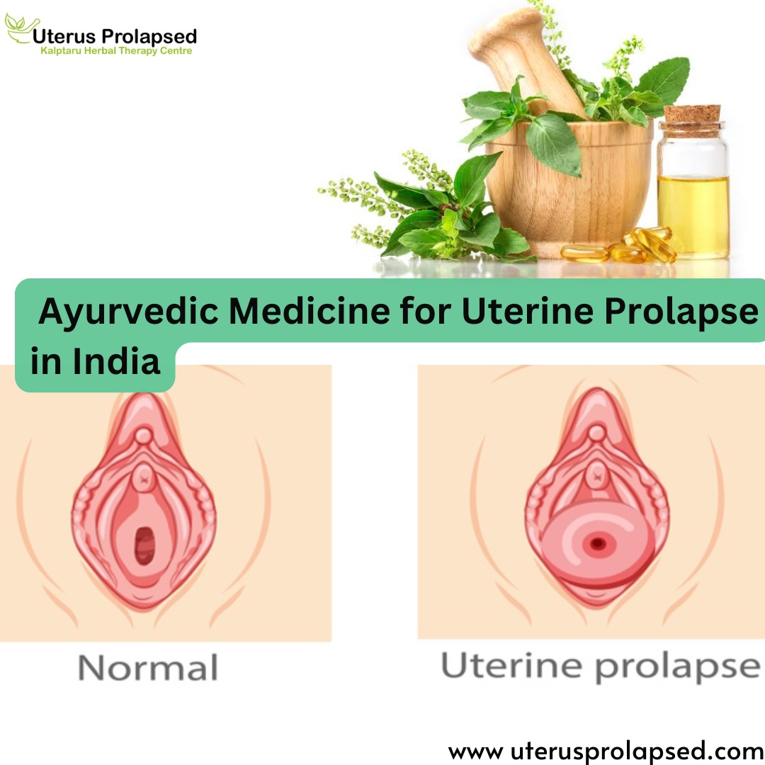 Ayurvedic Medicine for Uterine Prolapse in India