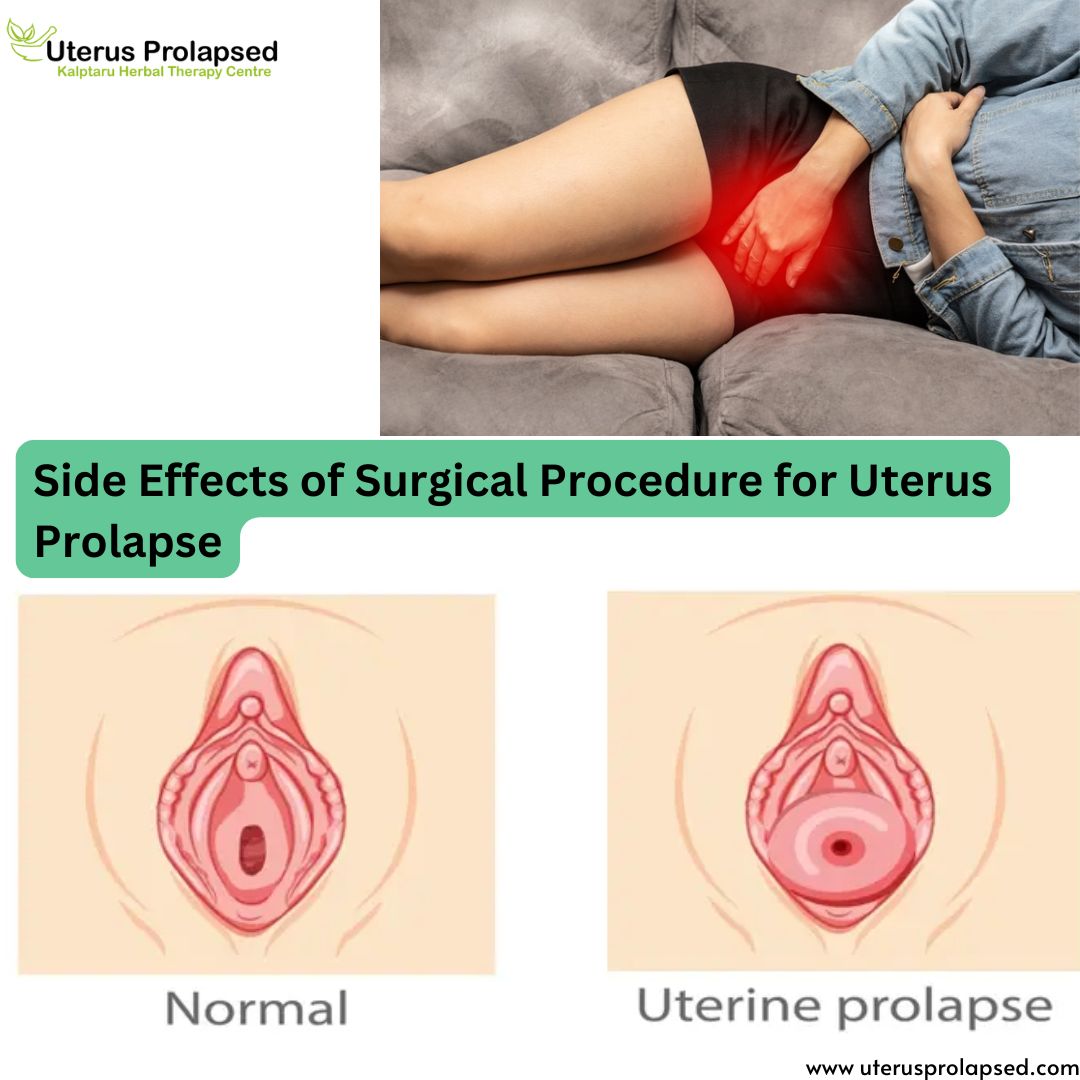 Side Effects of Surgical Procedure for Uterus Prolapse