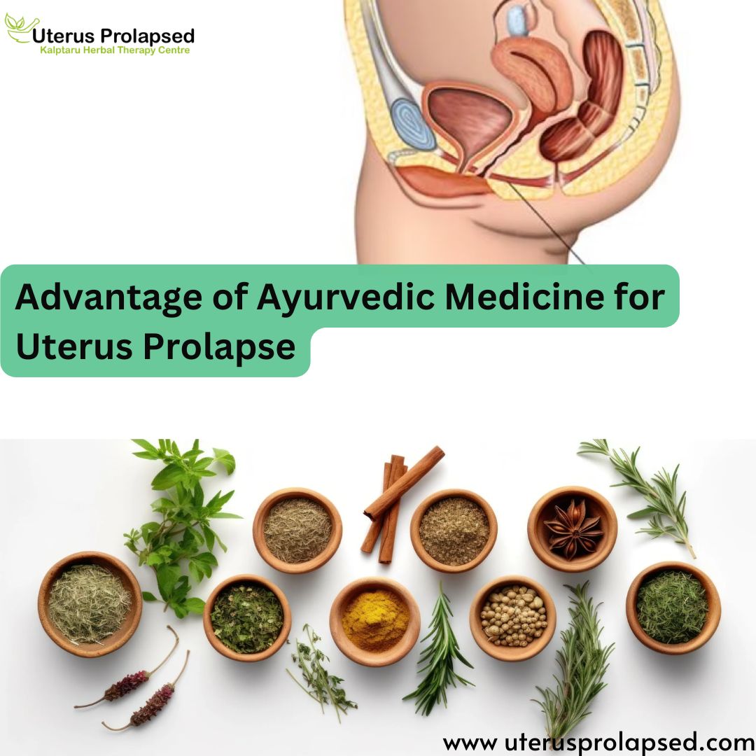 Advantage of Ayurvedic Medicine for Uterus Prolapse