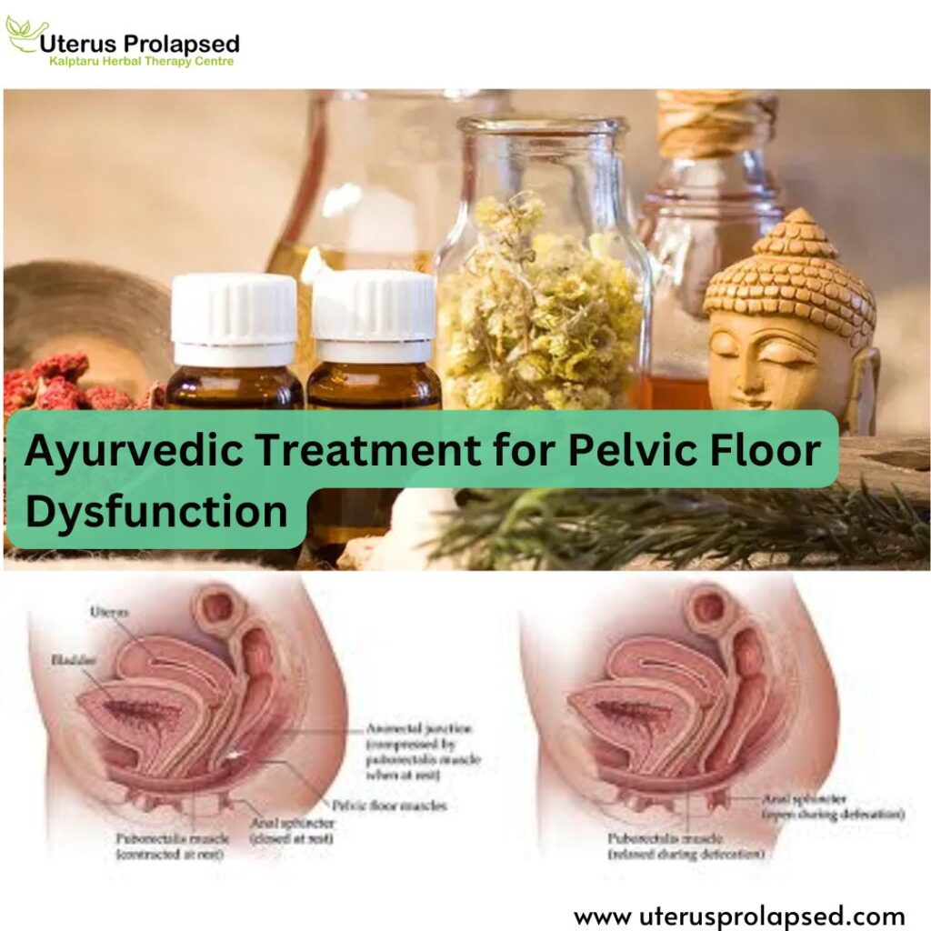 Ayurvedic Treatment for Pelvic Floor Dysfunction