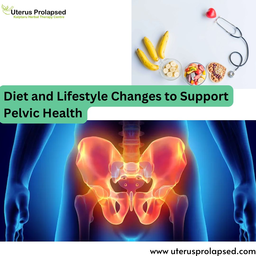 Diet and Lifestyle Changes to Support Pelvic Health