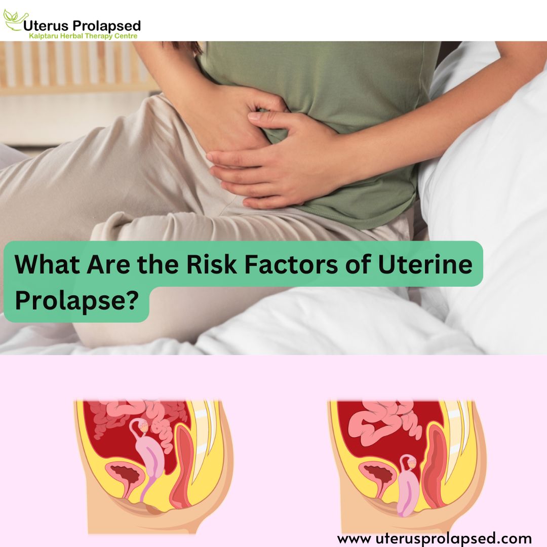 What Are the Risk Factors of Uterine Prolapse?