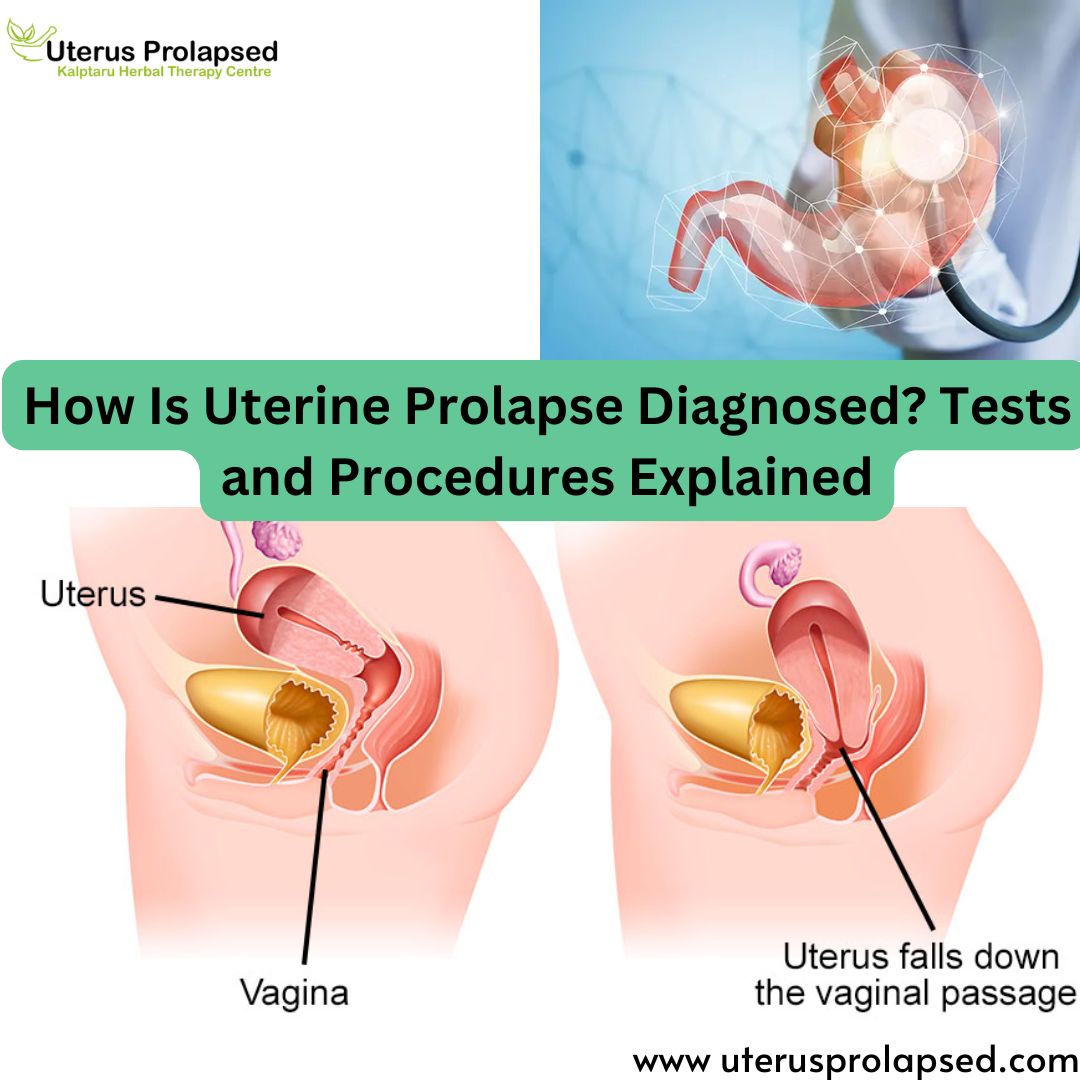 How Is Uterine Prolapse Diagnosed? Tests and Procedures Explained