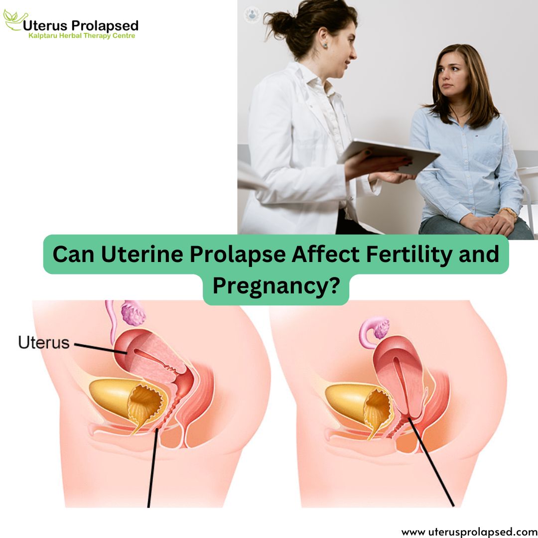 Can Uterine Prolapse Affect Fertility and Pregnancy?