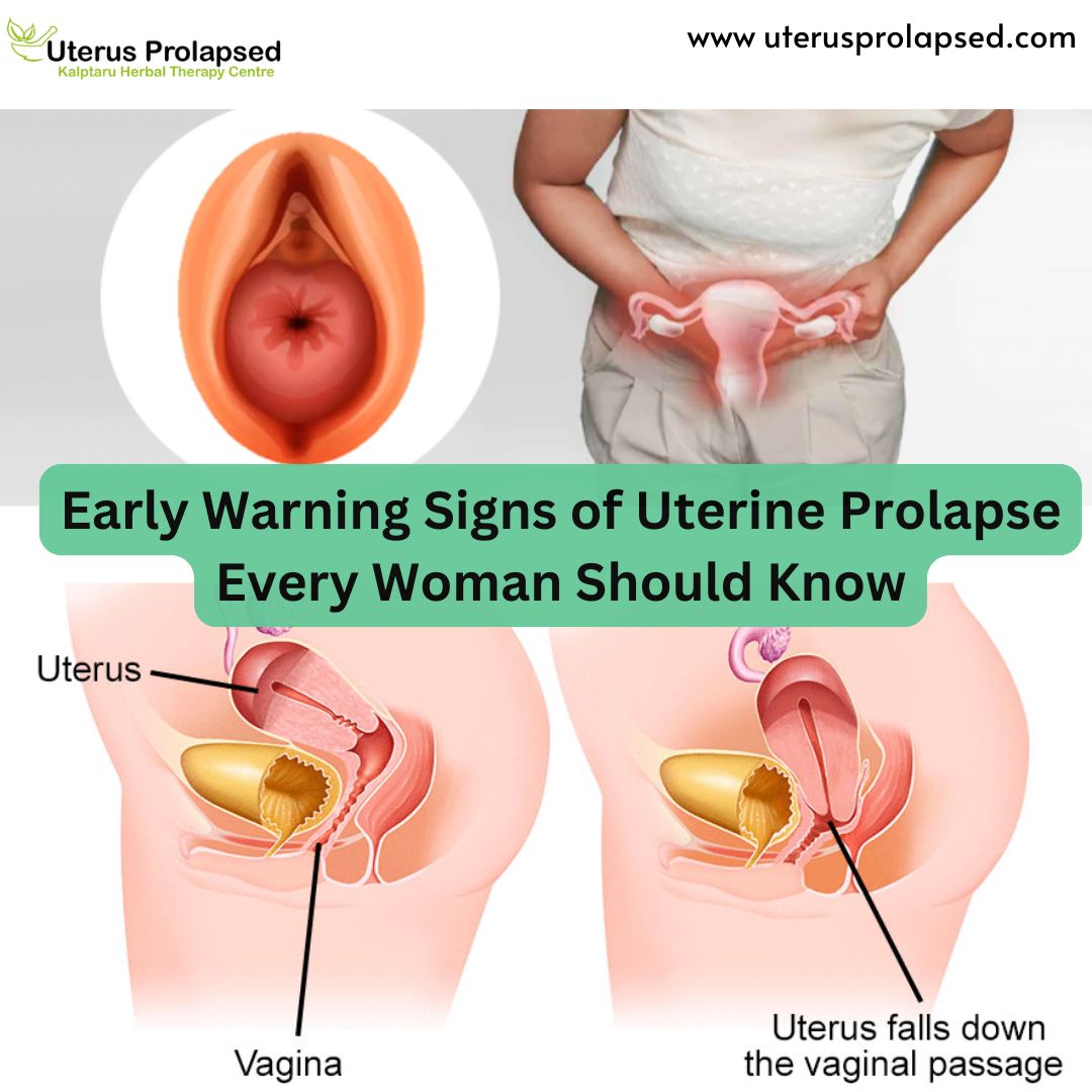 Early Warning Signs of Uterine Prolapse Every Woman Should Know