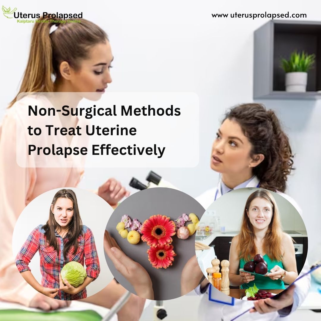 Non-Surgical Methods to Treat Uterine Prolapse Effectively