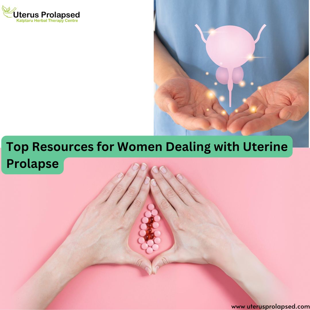 Top Resources for Women Dealing with Uterine Prolapse