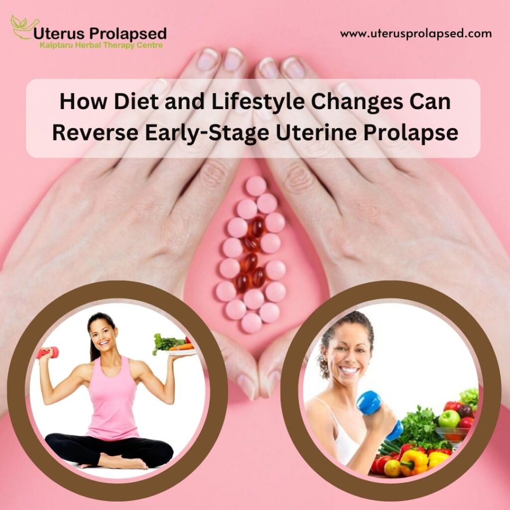How Diet and Lifestyle Changes Can Reverse Early-Stage Uterine Prolapse