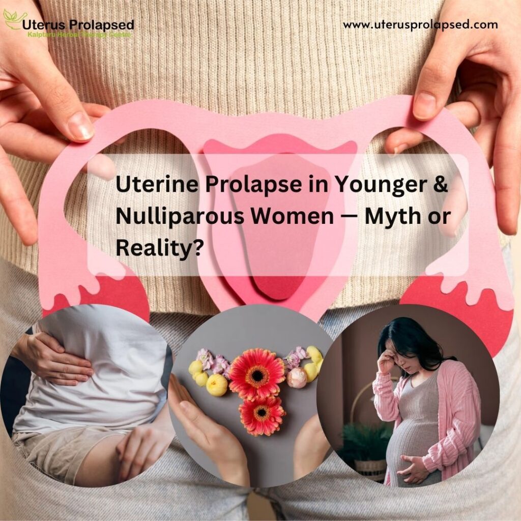 Uterine Prolapse in Younger & Nulliparous Women — Myth or Reality?