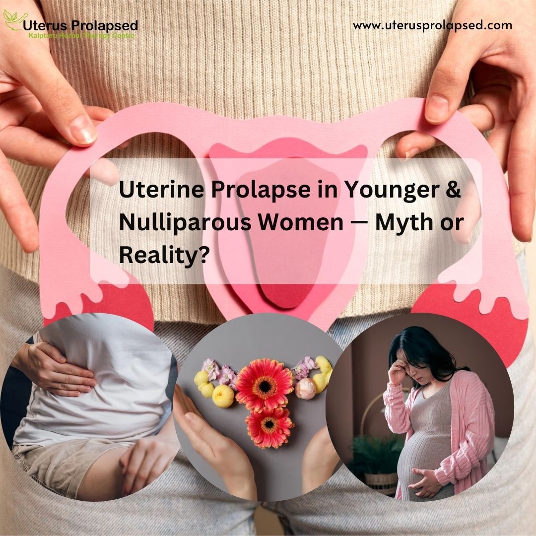 Uterine Prolapse in Younger & Nulliparous Women — Myth or Reality?