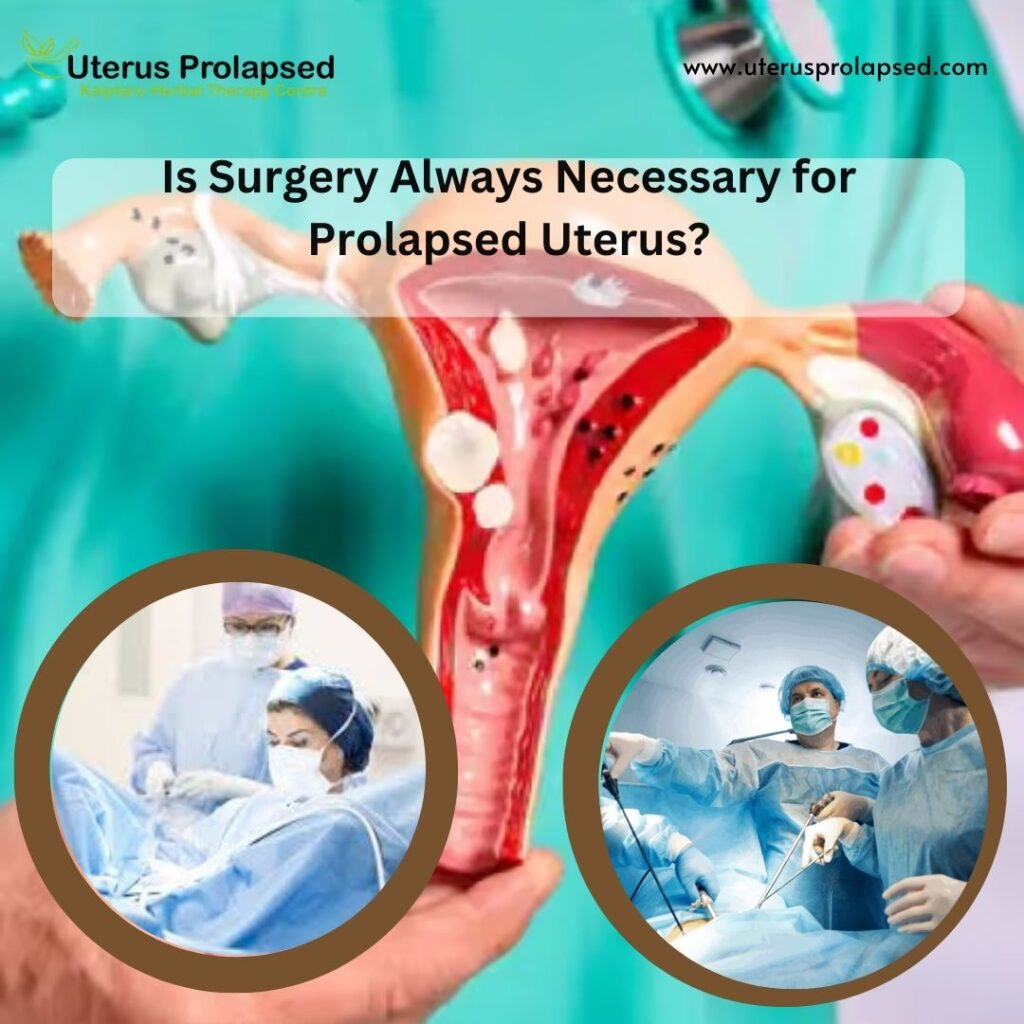 Is Surgery Always Necessary for Prolapsed Uterus?