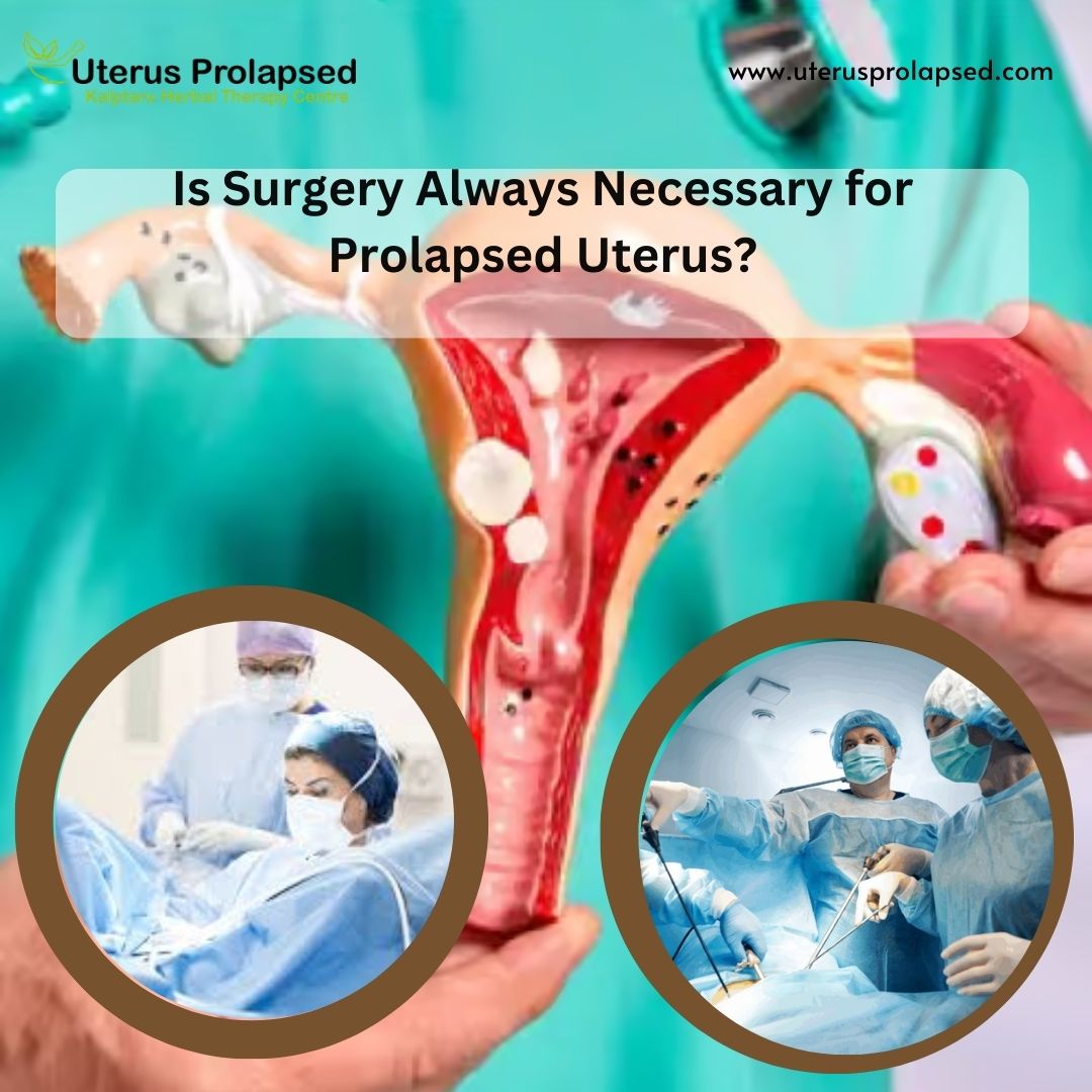 Is Surgery Always Necessary for Prolapsed Uterus?