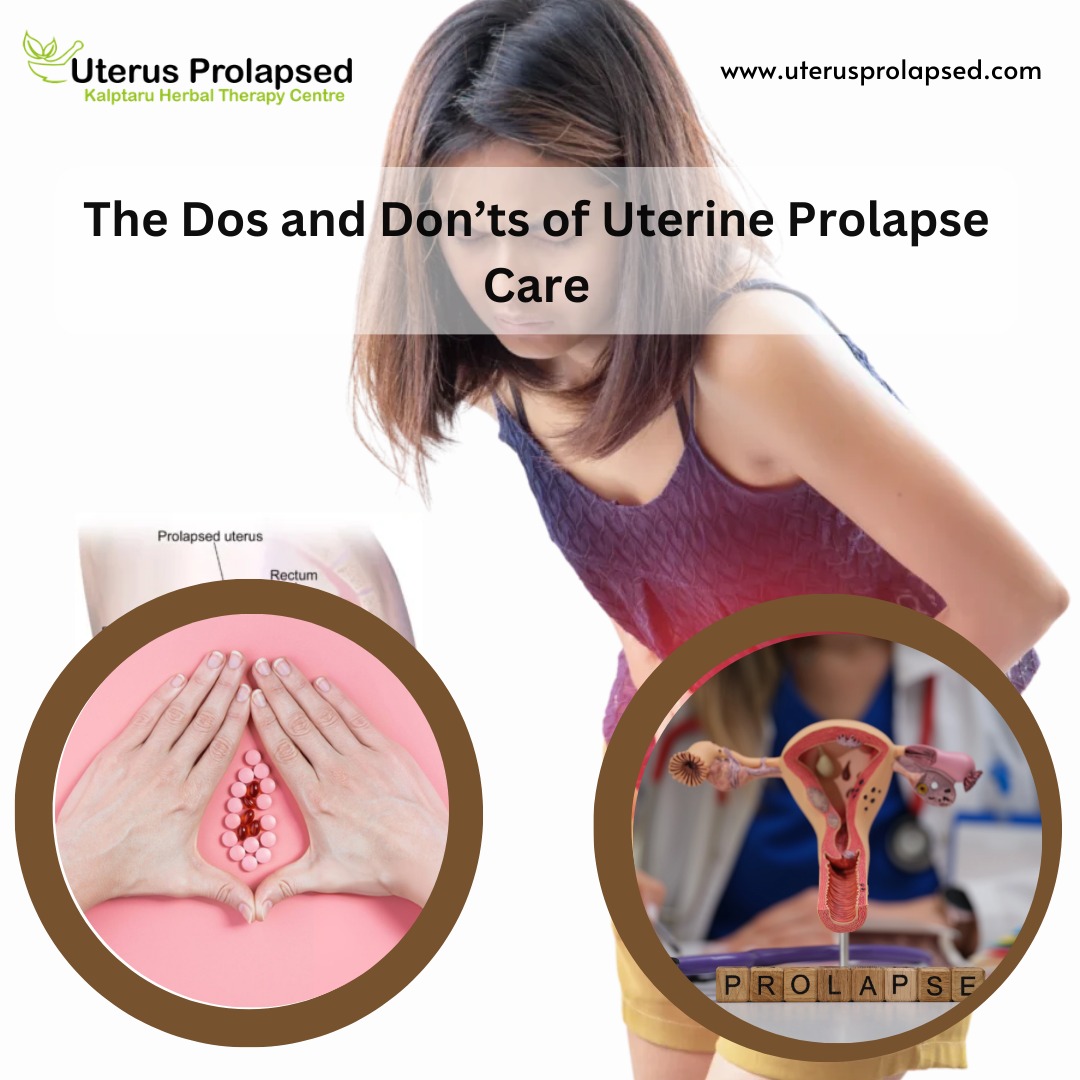 The Dos and Don’ts of Uterine Prolapse Care