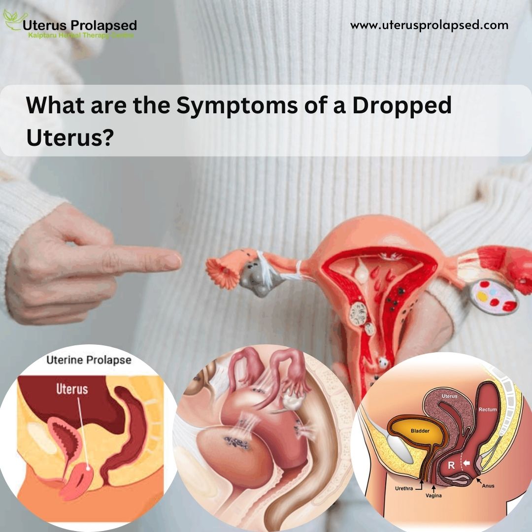 What Are the Symptoms of a Dropped Uterus?