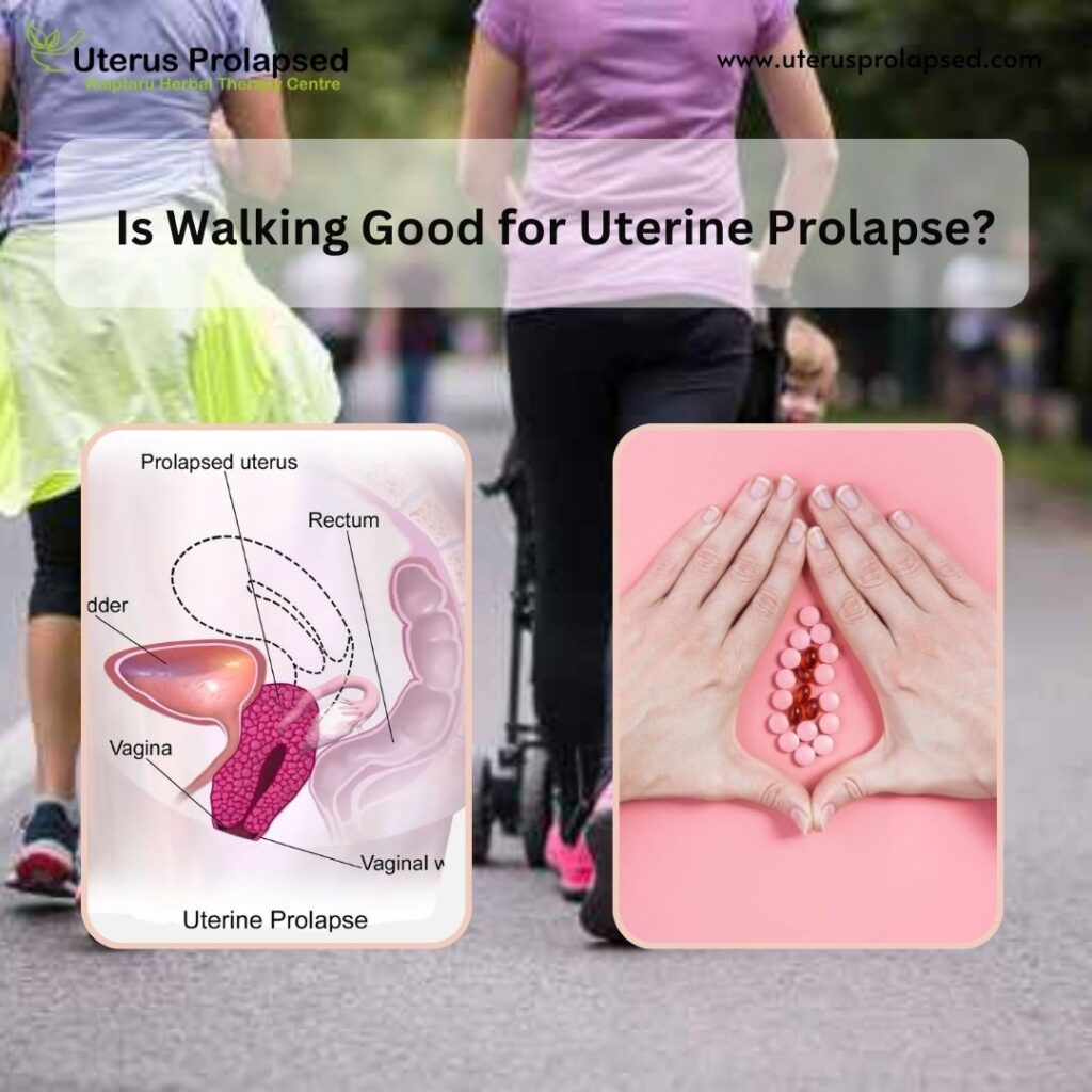 Prolapsed Uterus