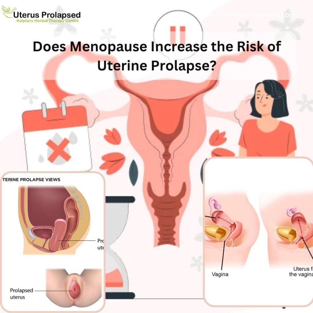 Uterus Prolapse