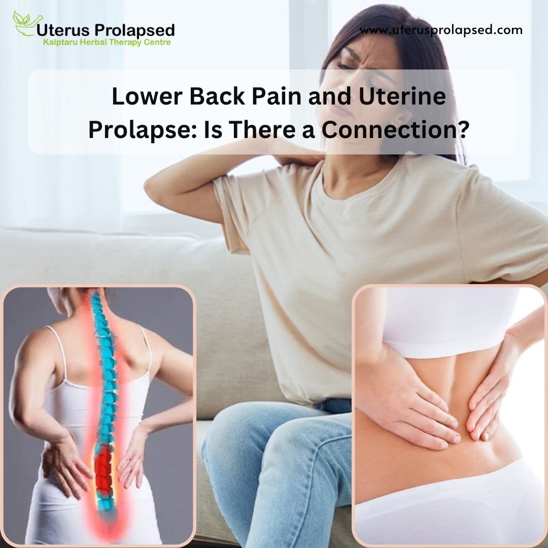 Uterine Prolapse