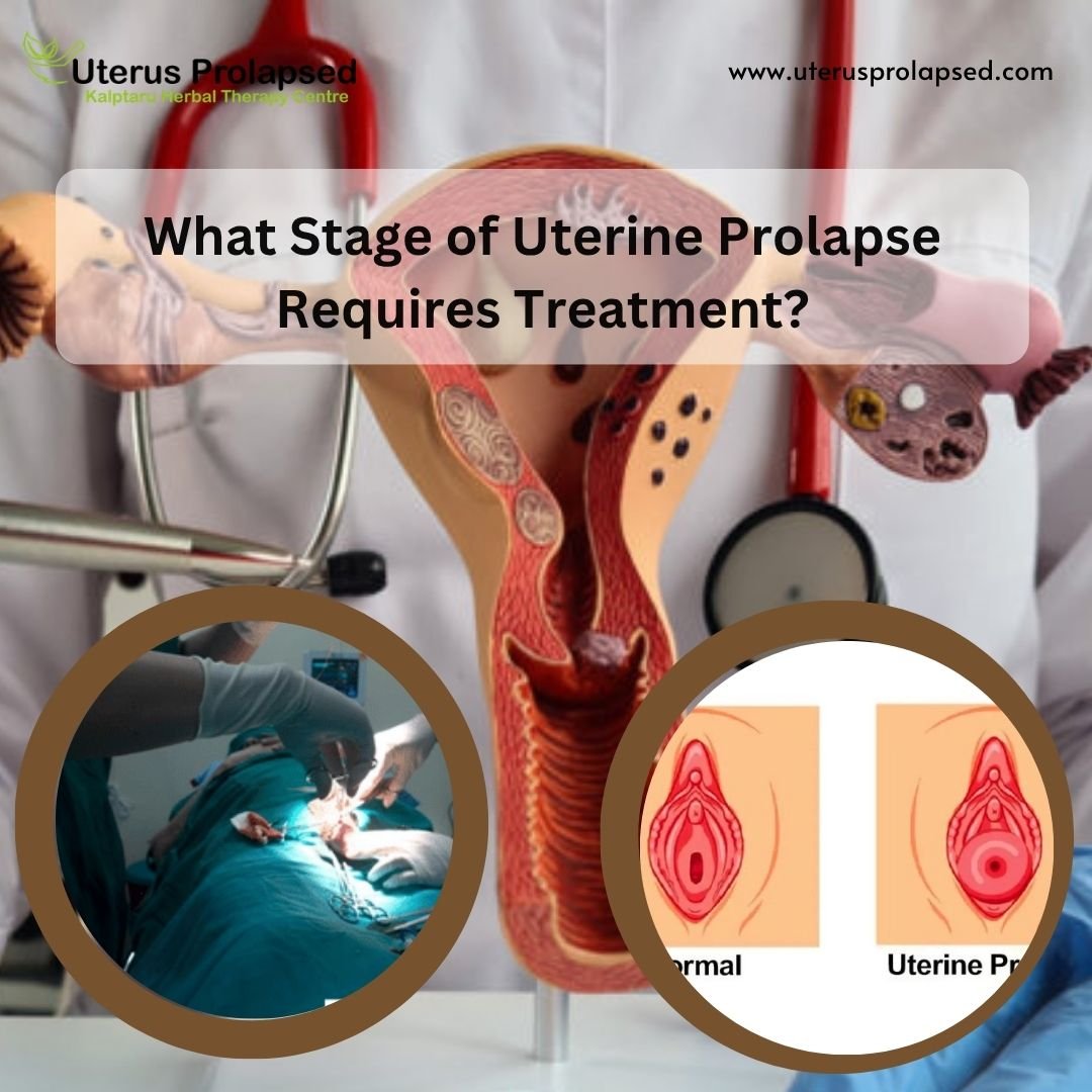 Uterine Prolapse
