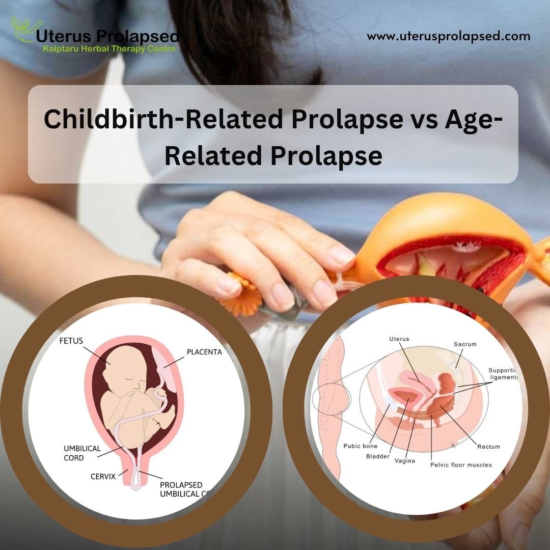 uterus prolapse